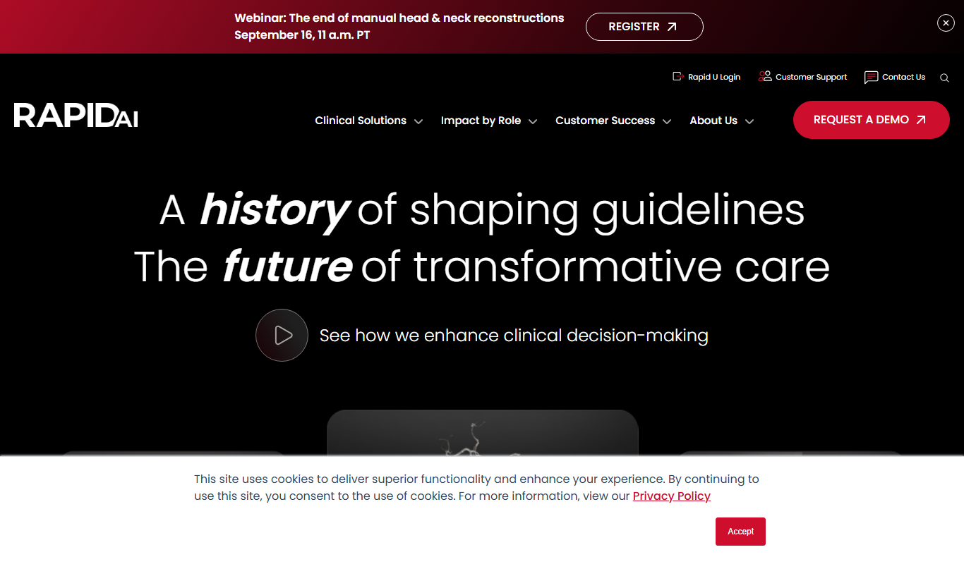Screenshot of RapidAI stroke imaging software interface